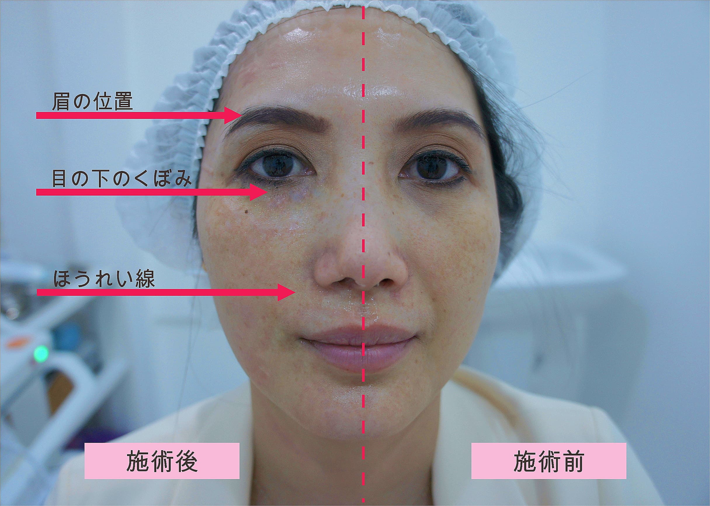 The natural ways to firm sagging skin